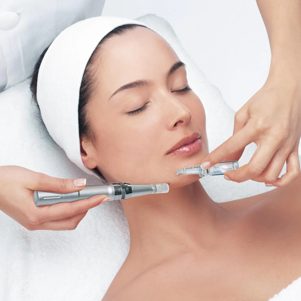 What You Need to Know About Microneedling for Glowing Skin